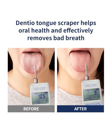 Tongue Scraper Cleaner (4 Pack) for Adults & Kids - Easy-to-Use Oral Care Solution - Buy Online on GoSupps.com