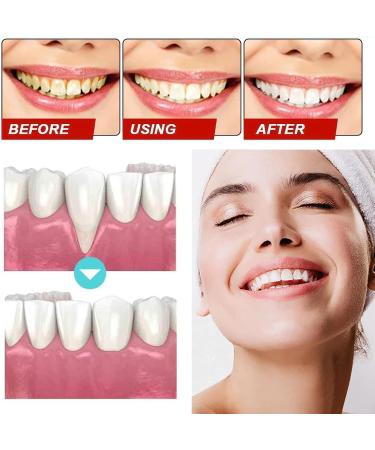 Gums Therapy Gel & Tooth Whitening Kit | 3-Piece Sensitive Teeth Solution - Buy Online on GoSupps.com