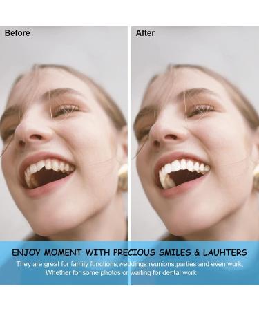 XZLZMD Reusable Prosthesis Teeth - Natural Color Unisex Immediate Repair for Cracked or Missing Dentures - 7 Pairs - Buy Online on GoSupps.com