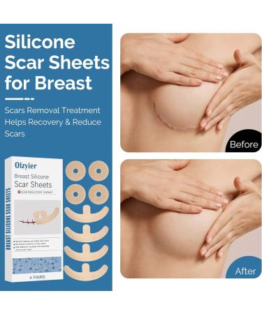 Silicone Scar Sheets for Breast | 8 Pack Invisible Surgical Scars Removal Tape | Scar Treatment for Recovery & Reduction - Buy Online on GoSupps.com