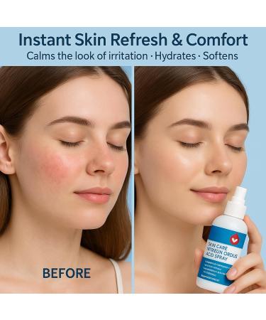  Nuvilo Hypochmic Acid Skin Care Spray 100ml Gentle Refreshing Mist for Sensitive Skin Lightweight and Soothing Formula for Daily Moisture and Skin Comfort - Buy Online on GoSupps.com