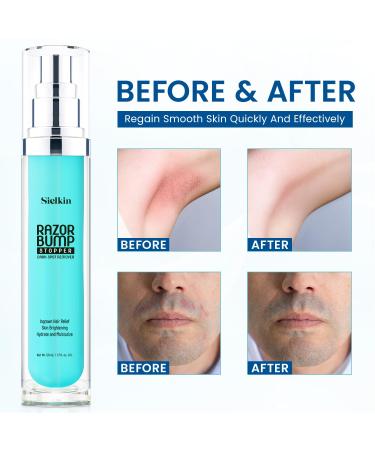 Shave Razor Bump & Ingrown Hair Aftershave Treatment Lotion - Sensitive Skin Care for Men & Women | Upgraded Formula 1.3 Fl Oz - Buy Online on GoSupps.com