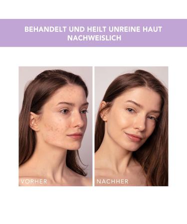 Foreo Espada 2 Plus - Targeted LED Skin Care Device for Impurities - FDA-Cleared Medical Silicone - Lavender - Scar & Stain Treatment - Buy Online on GoSupps.com