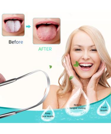 5PCS Medical Grade Tongue Scraper Set - BPA-Free, Great for Oral Care, Reduce Bad Breath - Adults and Kids - Buy Online on GoSupps.com