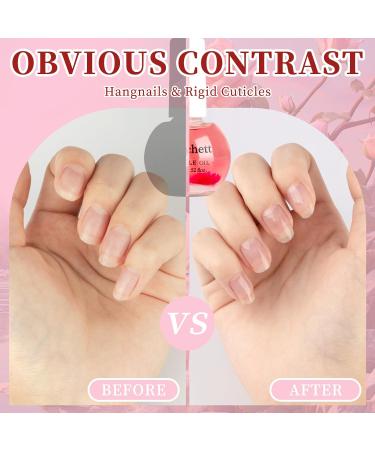 Sweet Almond Cuticle Oil for Nail Repair, Growth & Strength - 15ml (Rose) - Buy Online on GoSupps.com