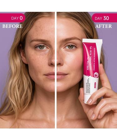 EELHOE Arbutin 7% + Tranexamic Acid 4% Cream 70 000ppm Arbutin & 40 000ppm TXA Moisturizing Hydrating Even Skin Tone Reduces Dark Spots & Pigmentation 1.76 fl.oz (1) - Buy Online on GoSupps.com