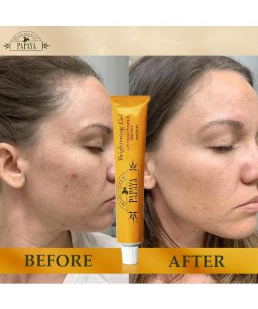 Organic Papaya Extract Whitening Gel - 30g | Natural Skin Brightening | International Shipping Available - Buy Online on GoSupps.com