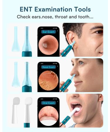 Bebird EarSight Ultra Ear Wax Removal Tool Camera FSA/HSA Eligible Ear Cleaner with 2K HD Flexible Otoscope & 5G WiFi Safe Visual Ear Camera with Light Ear Cleaning Kit for Whole Family - Buy Online on GoSupps.com