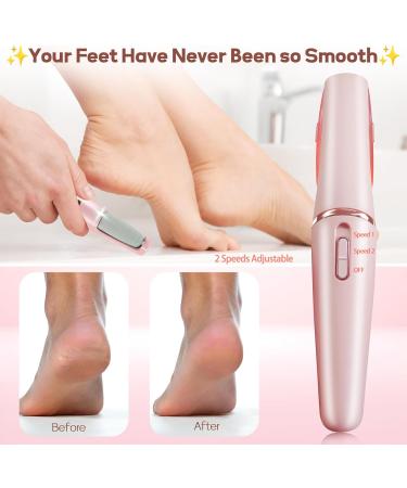 Smooth Pedicure Wand - Electric Foot Callus Remover | Rechargeable Pedicure Tool for Feet Care | Removes Dry Skin & Dead Skin - Ideal Gift (Pink - Buy Online on GoSupps.com