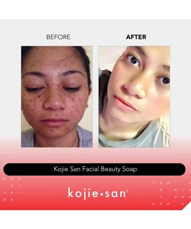 Kojie San Facial Beauty Soap 2 Bars Pack - Coconut - Reduces Discoloration & Hyperpigmentation - Skin Fairness & Moisturizing - 65g - Buy Online on GoSupps.com