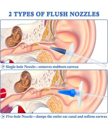 Buy Safe & Effective Ear Wax Removal Kit - Manual Ear Irrigation Flushing System for Adults Kids & Elders | Home Ear Cleaner - No Doctor Visit Required - Buy Online on GoSupps.com