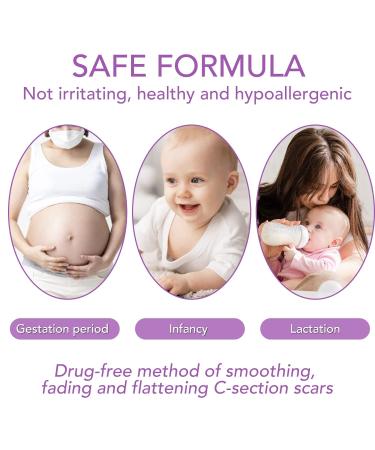 Soothing Silicone Scar Sheets Roll for C-Section, Surgery, Burns, Acne, Stretch Marks - 1.6 x 120 in - Reusable & Effective - Keloid Reduction - Buy Online on GoSupps.com