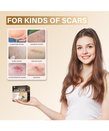 Medical Grade Silicone Scar Tape - 164x1.57 Roll for Scar Removal | C-Section Tummy Tuck Keloid & Surgical Scars | Reusable Silicone Scar Sheets - Buy Online on GoSupps.com