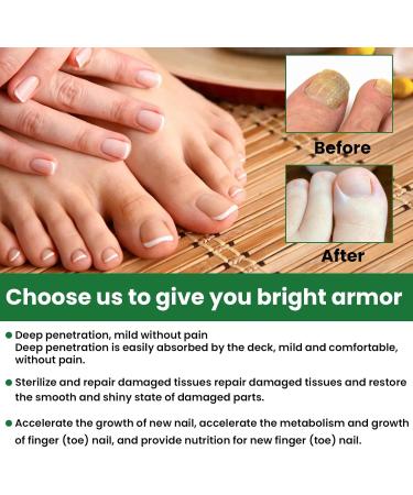 S rum pour ongles - 30 ml x 2 - Huile nourrissante pour les ongles et les cuticules - Traitement des ongles incarn s - Pour ongles craquel s rugueux cassants et fendus - Buy Online on GoSupps.com