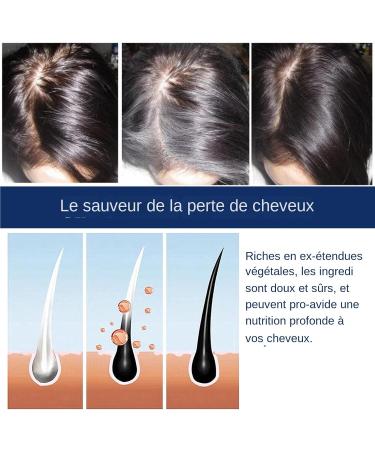 Beurre Capillaire Pour La Pousse Des Cheveux - Huile paississante Pour Cheveux Plus pais Et Denses | Texture L g re paississante Soin Quotidien Hommes Femmes - Buy Online on GoSupps.com