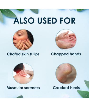 Rawleigh Medicated Ointment Stick 0.5 oz (14.2g) Classic Aromatic Chest Rub in Portable Stick Format for Cold Nasal Congestion with Camphor Menthol & Eucalyptus Non-Greasy Pack of 3 - Buy Online on GoSupps.com