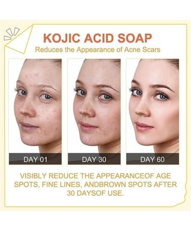 Lovelycat Savon de papaye claircissant la peau le savon de papaye contenant de l'acide hyaluronique r tinol am liore le teint in gal et hydrate le corps et le visage (3PC) - Buy Online on GoSupps.com