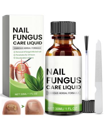 Toenail Care with Nail File Nourishing and Soothing for Nails Promotes the Regrowth of Healthy Nails 30ml