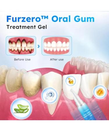 Furzero Oral Gum Treatment Gel Dentizen Gum Therapy Gel Furzero Gum Therapy Gel Gum Shield Therapy Gel Furzero Teeth Whitening Repair Regrowth Gel (2pcs) - Buy Online on GoSupps.com