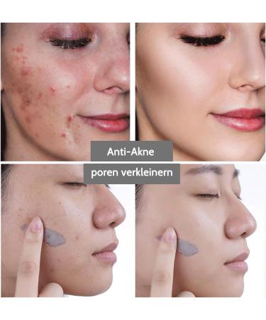 Face Mask - Dead Sea Mask - Clay Mask Face for Cleans Acne and Dark Spots Pores Reducing Face Masks Beauty 250 g - Buy Online on GoSupps.com