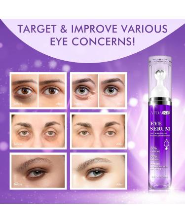 Eye Treatment Serum - 8% Caffeine & Retinol Hyaluronic Acid Niacinamide Peptides - Cream for Dark Circles Puffy Eyes Fine Lines - 360 Eye Roller Massage Ball Included 0.5 fl. oz - Buy Online on GoSupps.com