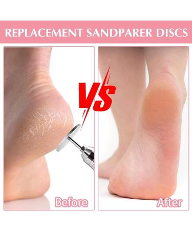 Buy Tiesome 61-Piece Grinding Discs for Pedicure - 25mm Feet Grinder Replacement Sanding Wheels for Dead Skin & Cracked Heels - Buy Online on GoSupps.com