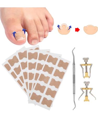 9Pcs Ingrown Toenail Corrector Strips Ingrown Toenail Treatment Strips Brace Foot Care Tool Kit Paronychia Toe Nail Fixer Pedicure Tool Nail Toenail Corrector Sticker Nail - Buy Online on GoSupps.com