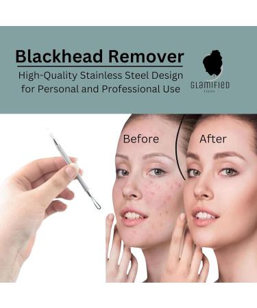 Glamified Blackhead Remover Professional Skincare Spot Treatment Blackhead Remover Tool for Blemish Comedone Whiteheads Pimple Popper with Double Sided Soft Touch and Anti-Slip Design - Buy Online on GoSupps.com