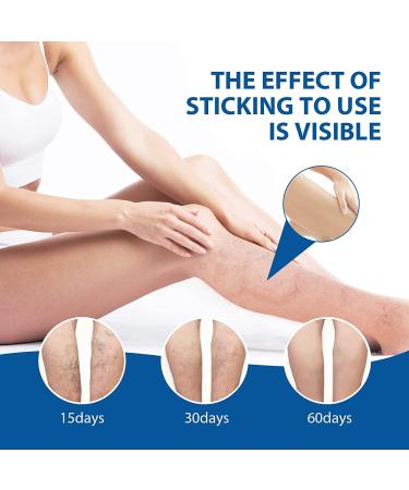 Veinhealth Blue Light Therapy Set for Varicose Veins - Effective Treatment Cream for Legs - Buy Online on GoSupps.com