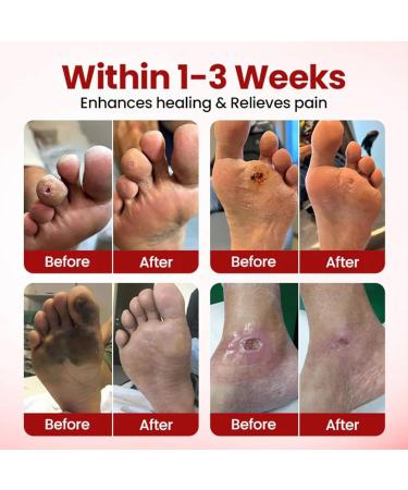  G n rique Cream for Cracked Feet | Moisturizing for Dry and Chapped Feet - Nourishing and Hydrating for Men Women Seniors Athletes Fathers and Mothers - Buy Online on GoSupps.com