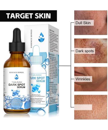 Dark Spot Correcting Serum Anti Ageing Face Serum with Niacinamide Hyaluronic Acid Serum Dark Spot Remover for Face Skincare Brightening Serum Reduce Age Spots Fine Lines Hyperpigmentation - Buy Online on GoSupps.com