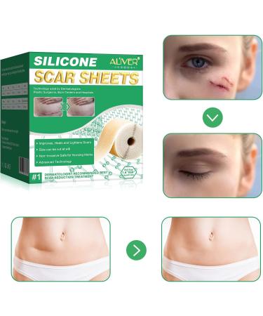 Silicone Scar Sheets Medical Grade Silicone Scar Tape Silicone Scar Strips for Scar Healing Painless Scar Removal Tape for All Surgical Incisions C-Section Burn Keloid Acne (1.6x60inch-1.5M) - Buy Online on GoSupps.com