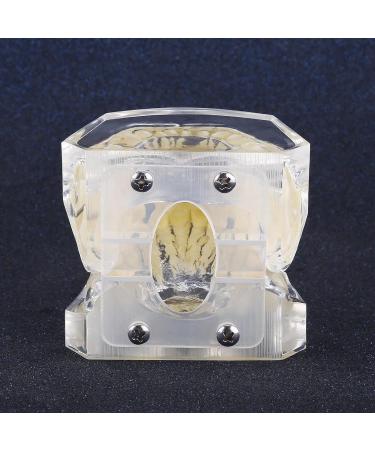 Dental Teeth Model with Metal Brackets - Orthodontic PVC Resin for Dental Schools - Buy Online on GoSupps.com