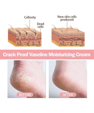 Cracked Heel Repair Cream Stick Foot Moisturizing Stick Foot Cream For Very Dry Feet Foot Cream For Calluses And Hard Skin Foot Moisturiser Callus Remover Soften For Feet Knees Hand - Buy Online on GoSupps.com