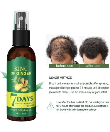 Hair Growth Germinal Oil Anti-Hair Loss Hair Growth Promotes Blood Circulation of the Scalp Prevents Hair Loss - Buy Online on GoSupps.com