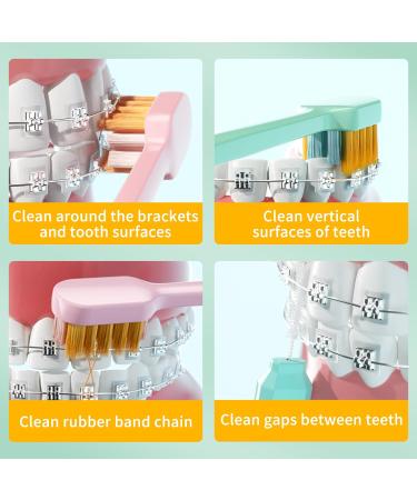 Y-Kelin Orthodontic Toothbrush 4 Pack | U-Shaped Soft Brush Head with Protective Covers for Effective Oral Care - Buy Online on GoSupps.com