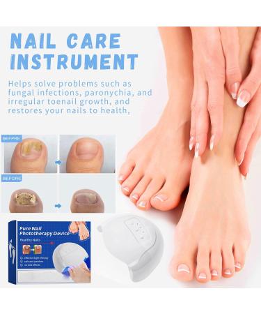 Get Rid of Nail Fungus Fast: Mecctuck & Furzero Laser Devices | Effective Nail Fungus Treatment - Buy Online on GoSupps.com