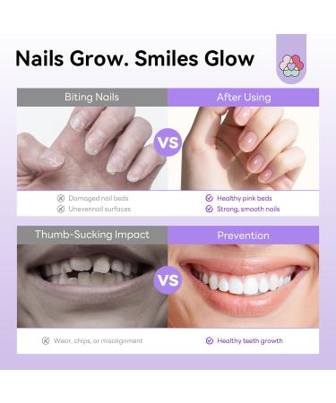  Saviland SAVILAND Nourishing Anti-Bite Nail Care Liquid 15 ml - Buy Online on GoSupps.com