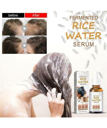 Xltyyds Puraect Fermented Rice Water Serum - Biotin Hair Growth Enhancer for Thinning Hair & Hair Loss (10ml 2PCs) - International Shipping Available - Buy Online on GoSupps.com