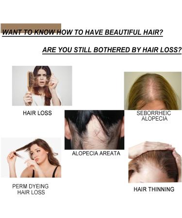  Pemarlis 100g Rice Shampoo Bar Shampoo Bar Natural Rice Soap For Thinning Hair And Hair Loss Effectively Promotes Hair Growth - Buy Online on GoSupps.com