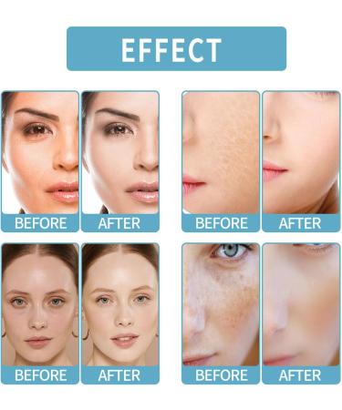 Nmbol Skin Lightening Serum B5 Spot Correction Serum B5 Corrector Serum Pigment Spot Remover Serum B5 Against Pigment Spots Wrinkle Reduction and Adolescent Radiation - Buy Online on GoSupps.com