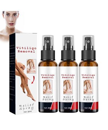 Alkyne Vitiligoremoval Relief Spray Kolmax Psoriasis Relief Spray Kolmaxtm Vitiligo Relief Spray Reduces White Spots on Skin (3PCS)