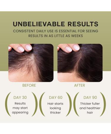 Batana Oil For Hair Growth - 100% Pure Raw & Natural Blend With Organic Castor Pumpkin Seed Coconut and Rosemary Oil - Thicker Stronger Hair Gifts For Men & Women Scalp (1 Pack) 4 Fl Oz (Pack of 1) - Buy Online on GoSupps.com