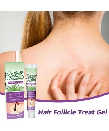 Scalp Moisturizer - Gel l ger - 20 g - Soin apaisant du cuir chevelu - Pour les soins quotidiens et saisonniers la maison - Pour homme et femme - Buy Online on GoSupps.com