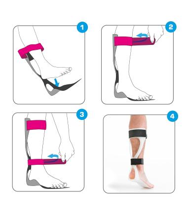 Neo-G Foot Drop Brace AFO - Class 1 Medical Device for Drop Foot Nerve Injury Relief - L - Right - Buy Online on GoSupps.com