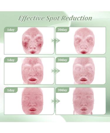Bablabear 2% Salicylic Acid Acne Treatment Cream for Face Back/Butt/Body Spot Treatment for Pimples Face Blemishes Blackheads Oil Control Ingredients are Natural Suitable for Teenagers/Women/Men(30g) - Buy Online on GoSupps.com
