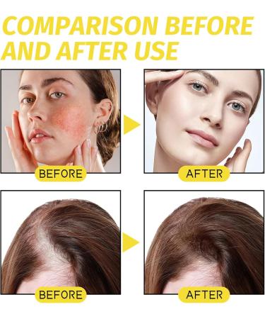 Black Seed Oil Black Seed Oil for Hair & Face Black Seed Hair Growth Serum Hair Serum for Dry Damaged Hair Face & Hair Anti Aging Face Serum Natural Hair Growth Serum Hair Growth & Smooth Your Skin - Buy Online on GoSupps.com