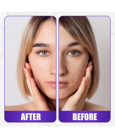 Snail Mucin Moisturizer Cream - Advanced Snail 92% All In One Cream Korean Moisturizer for Face Made with Snail Serum for Dry Sensitive Skin - Korean Skincare Daily Face Moisturizer Repair Cream (100 g / 3.52 Fl Oz) - Buy Online on GoSupps.com