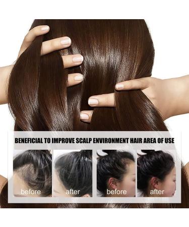 Katutude Hair Regrowth Essence Herbal Hair Growth Serum 40ML Natural Hair Regrowth Lotion Nourishing Serum for Women Men Prevent Hair Loss and Promote Stronger Longer Hair (5 Pack) - Buy Online on GoSupps.com