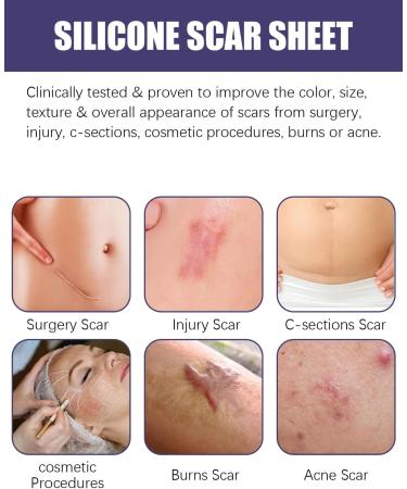 GAJUS 30 g scar gel for adults scar care gel to reduce surgical and old scars moisturizing scar cream for rapid regeneration and care - Buy Online on GoSupps.com